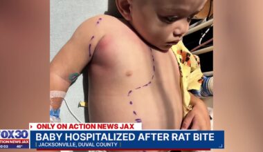‘Could have killed my child:’ Jacksonville mom says toddler bitten by rat in HUD housing – Action News Jax