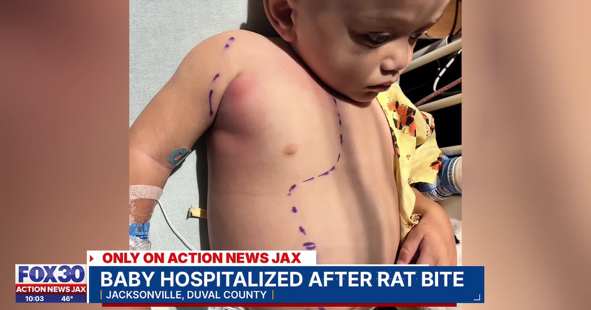 ‘Could have killed my child:’ Jacksonville mom says toddler bitten by rat in HUD housing – Action News Jax