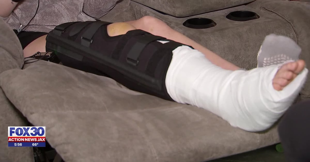 Jacksonville DUI crash victim shares survival story to warn others against driving and drinking – Action News Jax