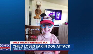 Doctors can’t save child’s ear after reported dog attack in Jacksonville neighborhood – Action News Jax