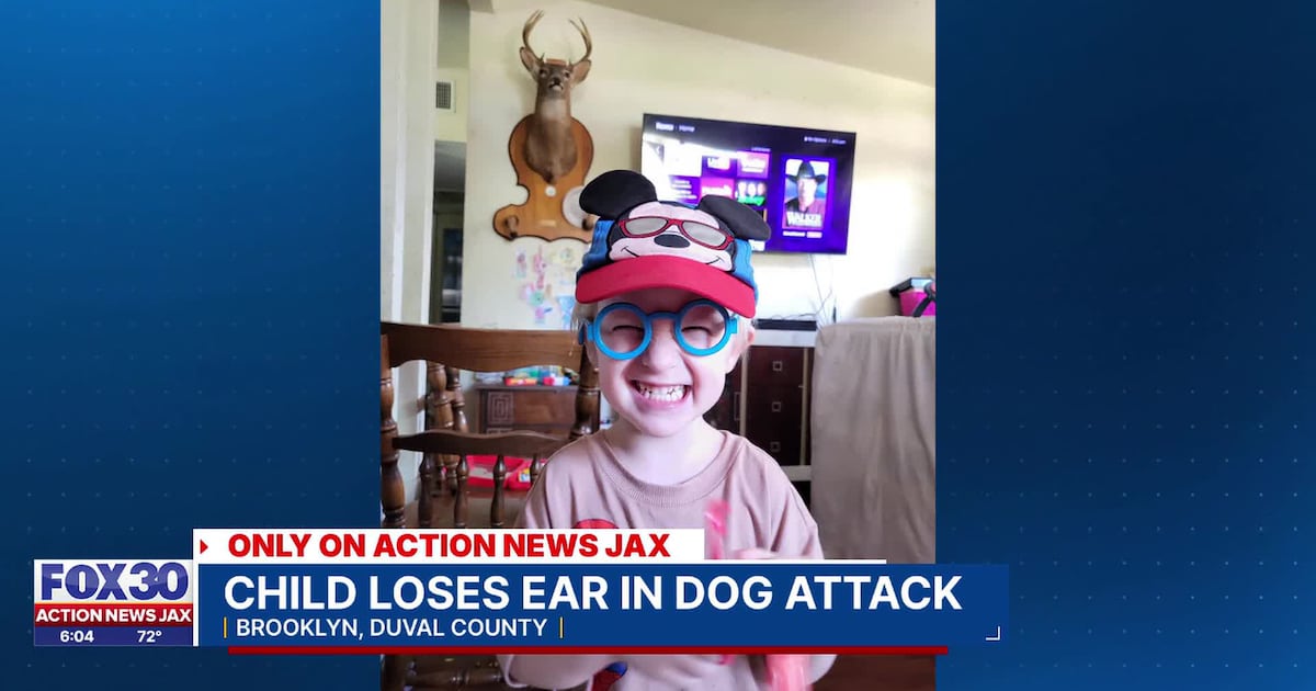 Doctors can’t save child’s ear after reported dog attack in Jacksonville neighborhood – Action News Jax