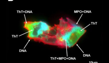 People With Long Covid Have This Freaky-Looking Thing in Their Blood