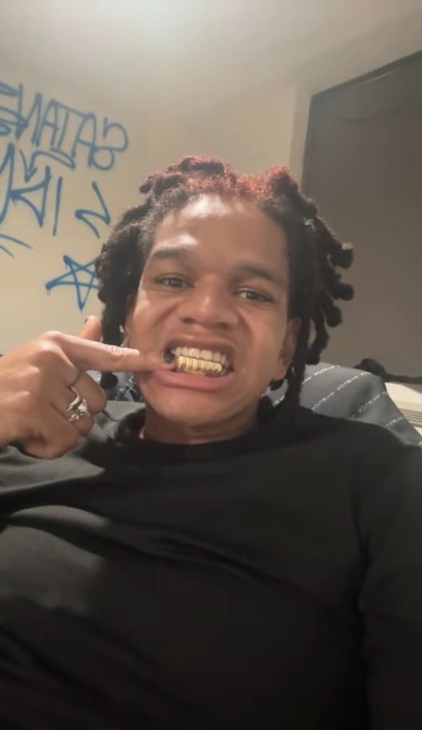 David showing his gold grill and pointing to it.