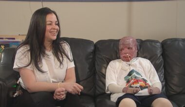 10-year-old burned in Philadelphia plane crash closer to coming home after almost 1 year of treatment