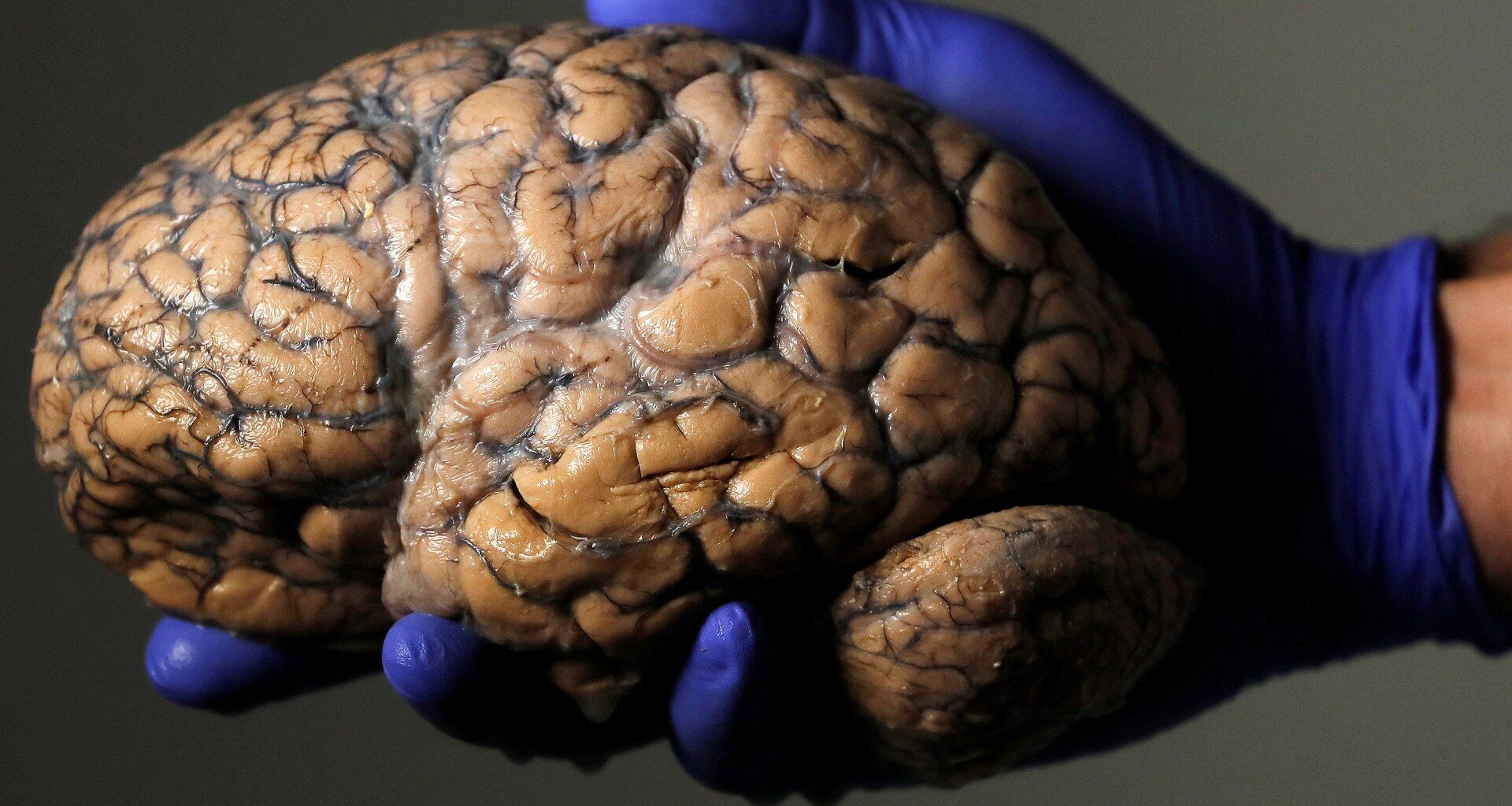 Does adolescence last until 32? Scientists unlock brain’s five eras | Health News