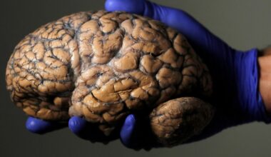 Does adolescence last until 32? Scientists unlock brain’s five eras | Health News