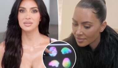 Kim Kardashian's brain scan shows 'low activity' after aneurysm