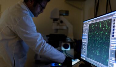 Why autoimmune diseases mostly strike women and are often misdiagnosed