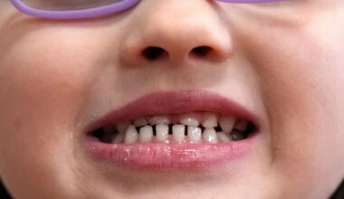 FDA restricts use of kids' fluoride supplements, citing emerging health risks