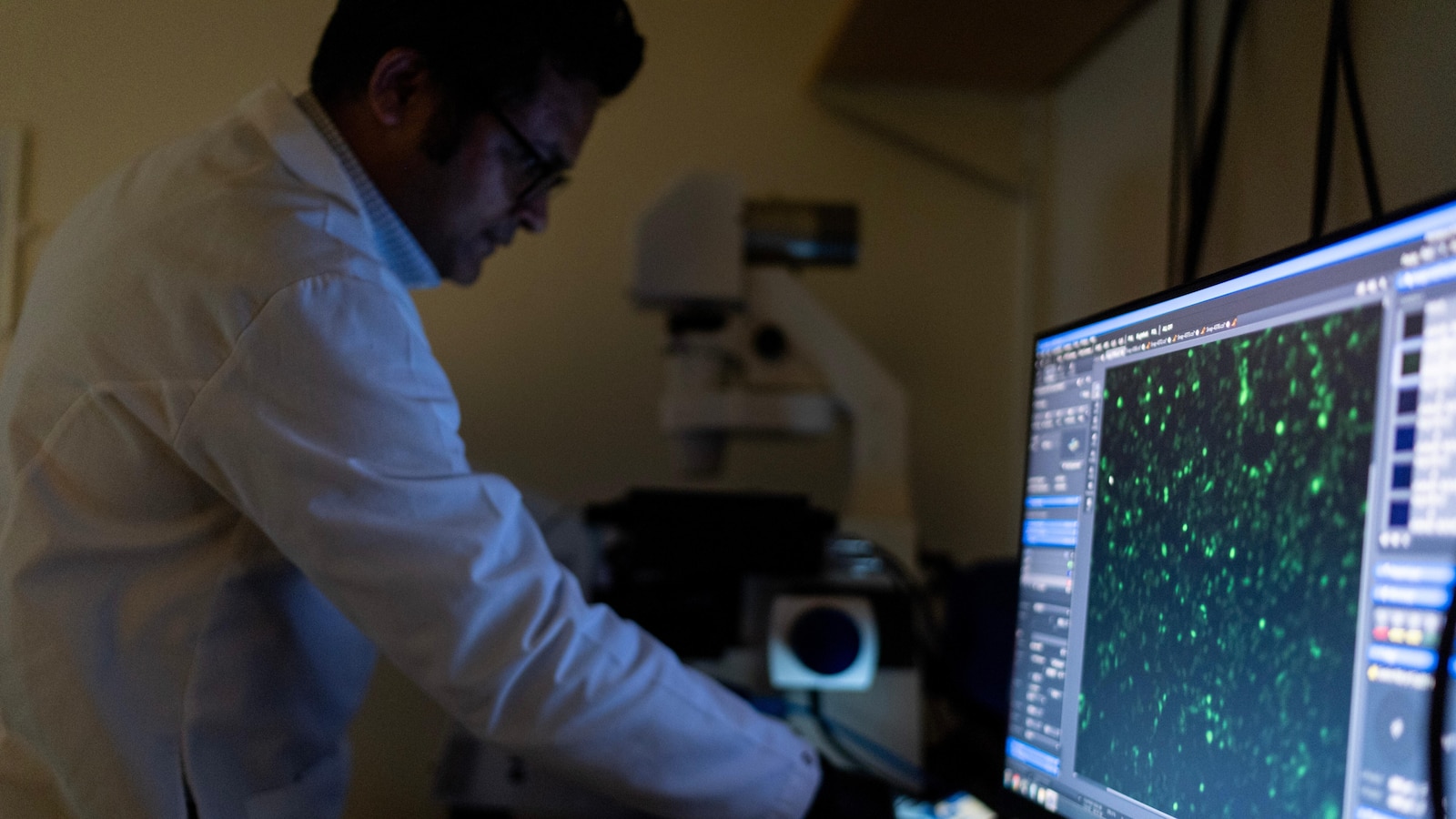 There are more than 100 autoimmune diseases, and they mostly strike women. Here's what to know