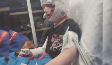 'Complete shock': Jacksonville mom recounts dog attack where 4-year-old son's ear was ripped off