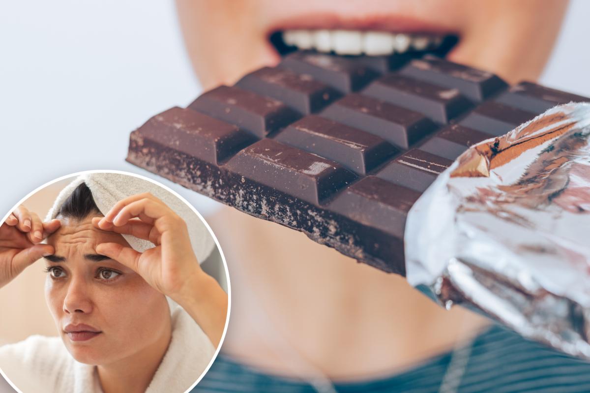 Chocolate can slow aging, why docs say you shouldn't eat more