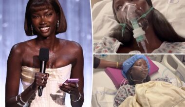 Supermodel Anok Yai, 28, diagnosed with congenital defect that's 'destroying' her lungs