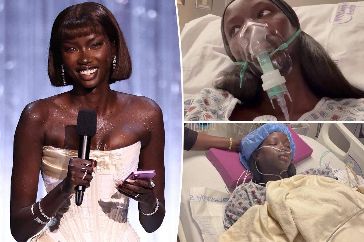 Supermodel Anok Yai, 28, diagnosed with congenital defect that's 'destroying' her lungs