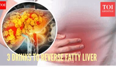 Top Gastroenterologist reveals 3 drinks that can reverse fatty liver, 'Small, daily habits can genuinely reduce inflammation, improve fat metabolism, and...."