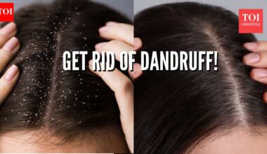 4 home remedies that actually work