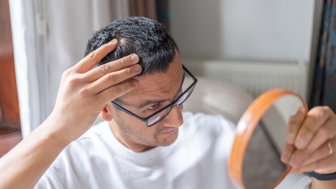 New hair loss treatment shows significant improvement over placebo