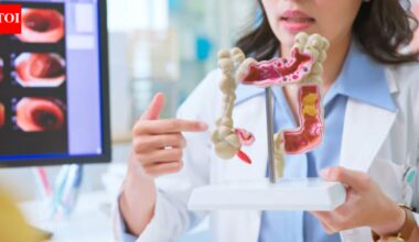 Colon cancer myths that mislead patients, pretend to be harmless, and delay diagnosis |