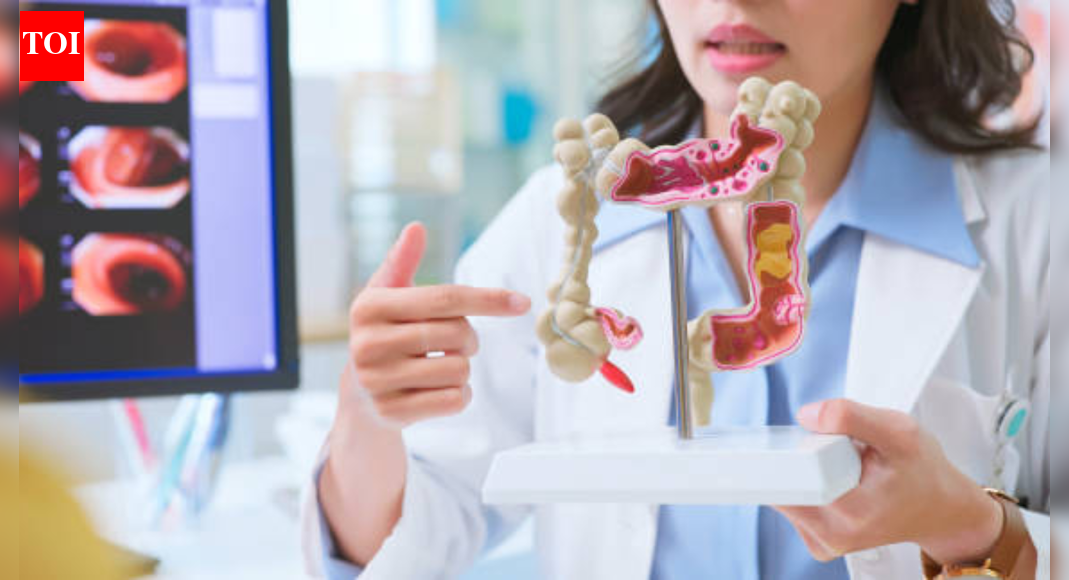 Colon cancer myths that mislead patients, pretend to be harmless, and delay diagnosis |