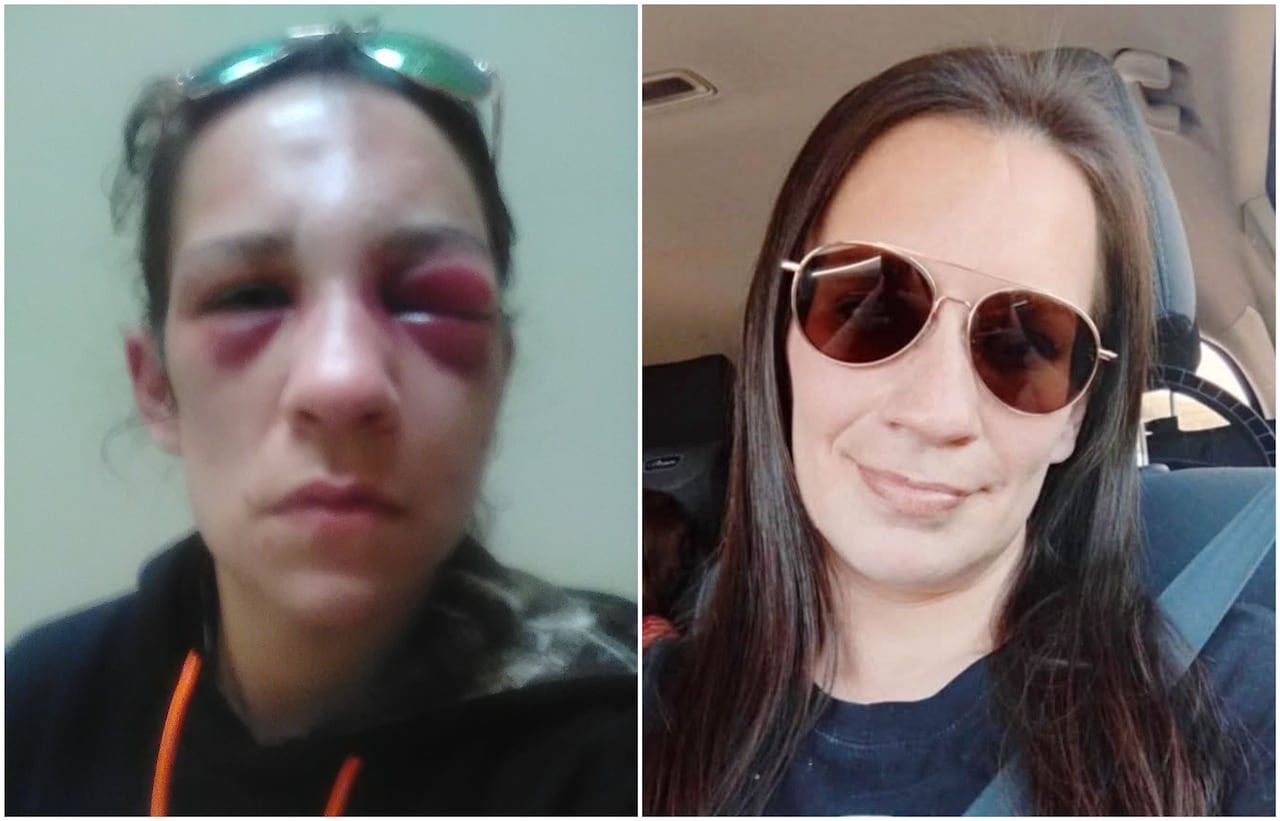 A composite image shows two photos of the same woman. In the photo on the left, her face has been beaten. She has two black eyes and one is swollen shut. In the photo on the right, she is sitting in a car smiling.