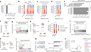 p53 inactivation drives breast cancer metastasis to the brain through SCD1 upregulation and increased fatty acid metabolism