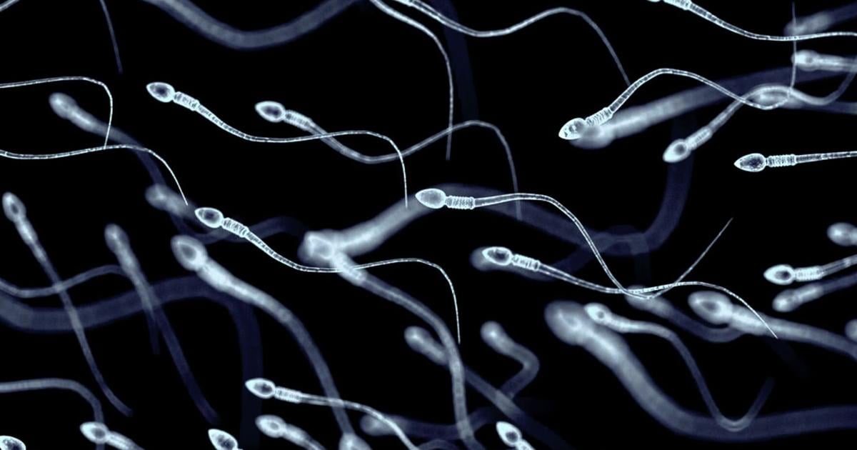 At least 197 children were fathered by sperm donor with cancer-causing gene. Some have already died | News