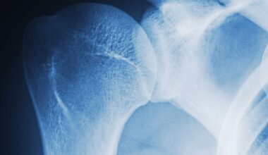 Celebrities and Influencers Look Emaciated