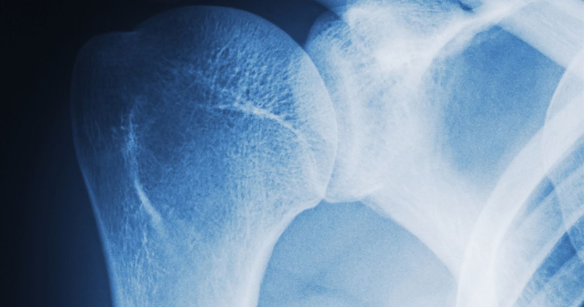 Celebrities and Influencers Look Emaciated