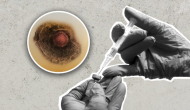 Study finds Shingles vaccine may reduce risk of Dementia