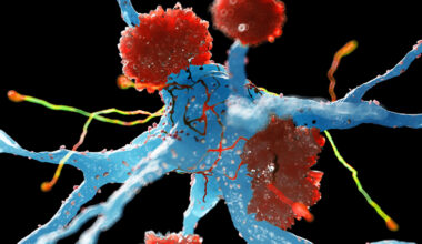 Switch Turns Brain's Defenses Into Protectors Against Alzheimer's : ScienceAlert