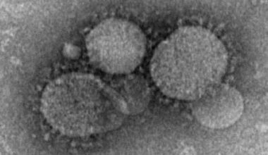 France confirms 2 MERS coronavirus cases in returning travelers