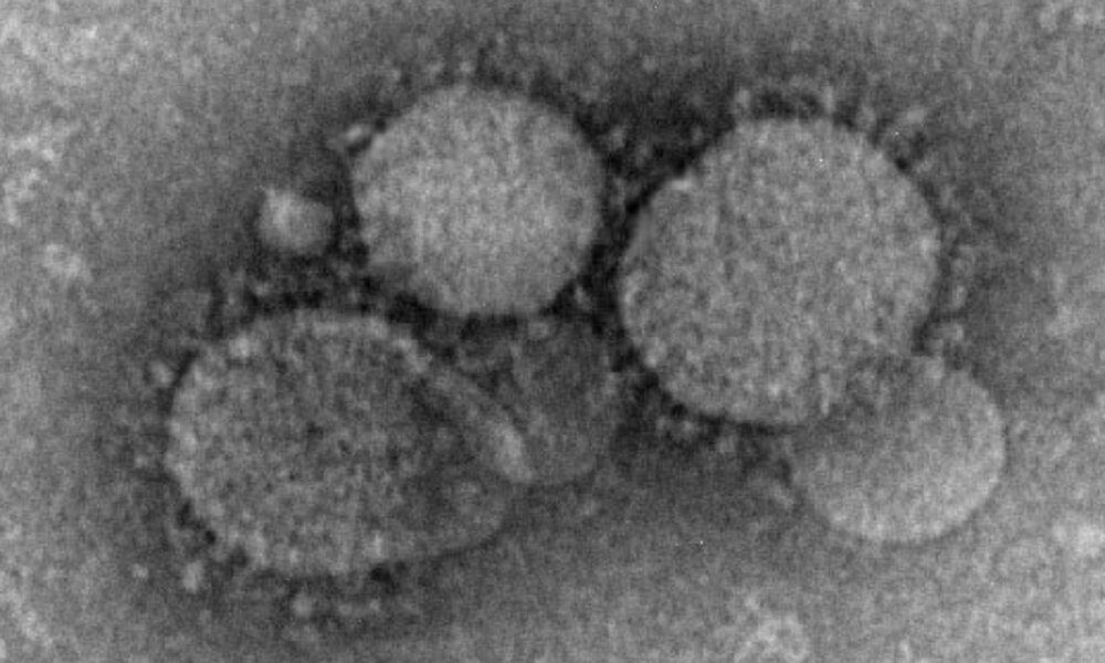 France confirms 2 MERS coronavirus cases in returning travelers