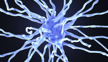 New Drug Stalls Alzheimer's Development in Breakthrough Trial : ScienceAlert