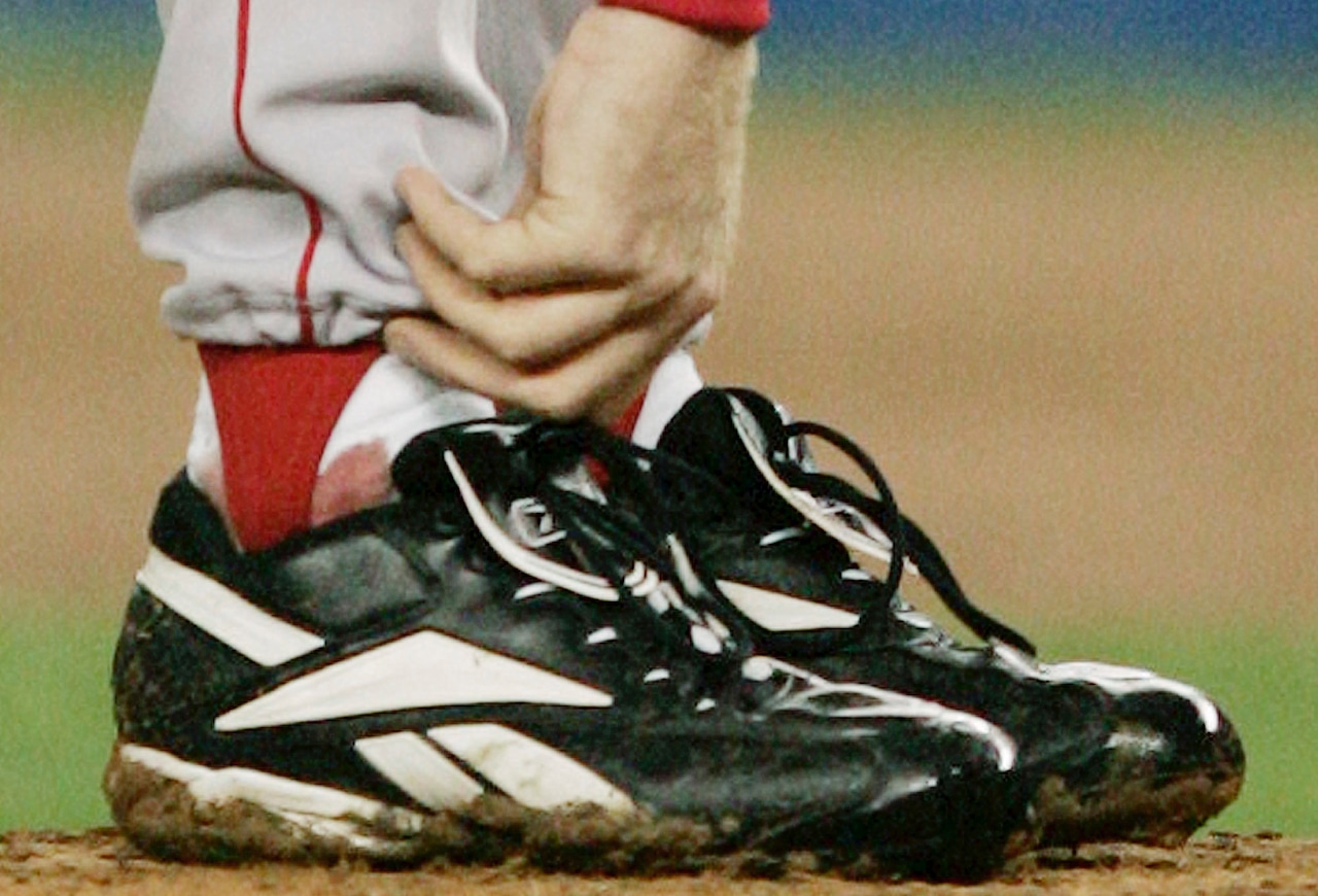 Curt Schilling