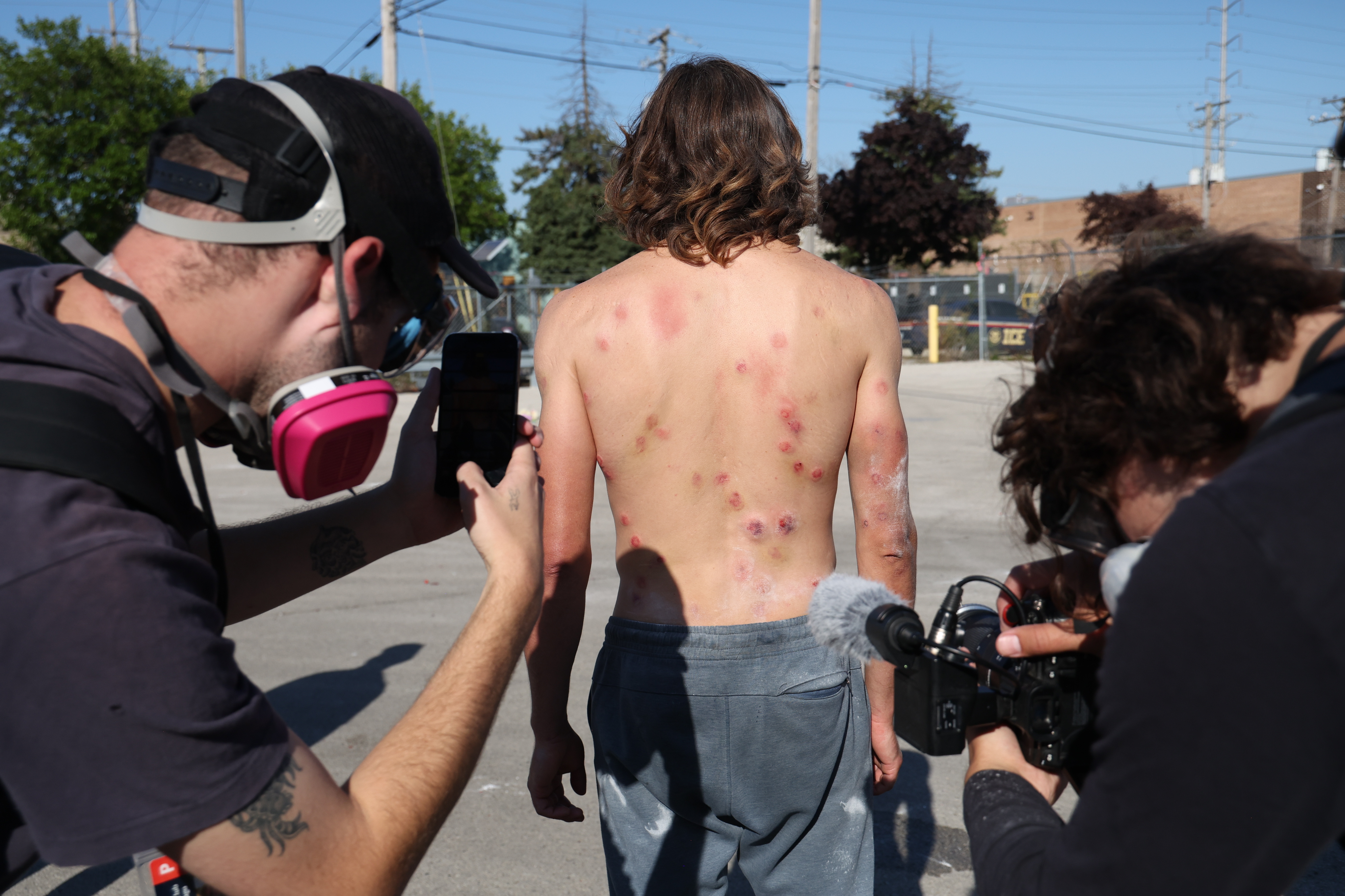 Levi Rolles is seen with several bruises from baton shots...