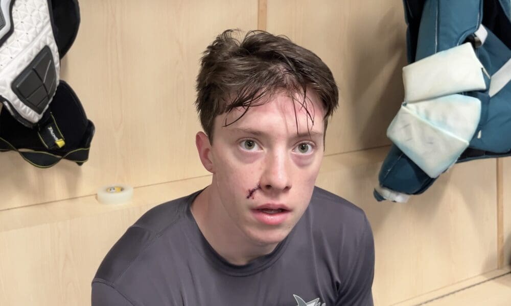 Preview/Lines #37: Graf Describes Injury Ordeal, Jokes About Wearing Bubble