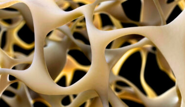 New Breakthrough to Strengthen Bone Could Reverse Osteoporosis : ScienceAlert