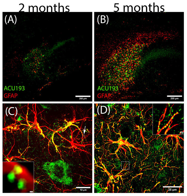 Neuron progress diagram
