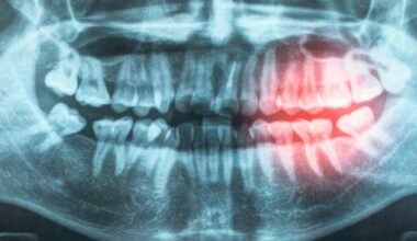 Gum Disease Linked to Heart Risks : ScienceAlert