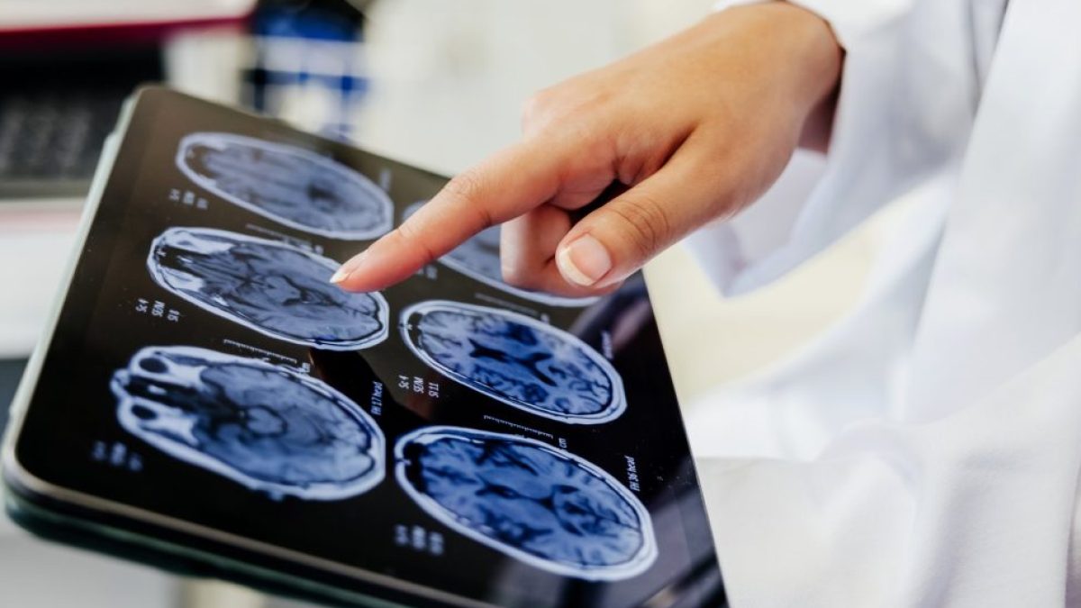 Depression, anxiety and PTSD have same genetic roots – what it means for treatment