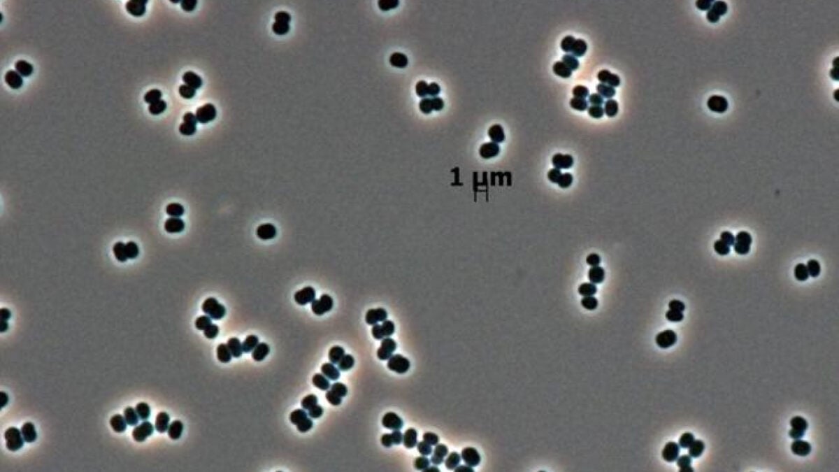 This Microbe 'Plays Dead' in NASA Clean Rooms, and We May Have Sent It to Mars