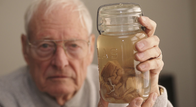 Albert  Einstein’s brain was stolen by a doctor and carried around for 40 years