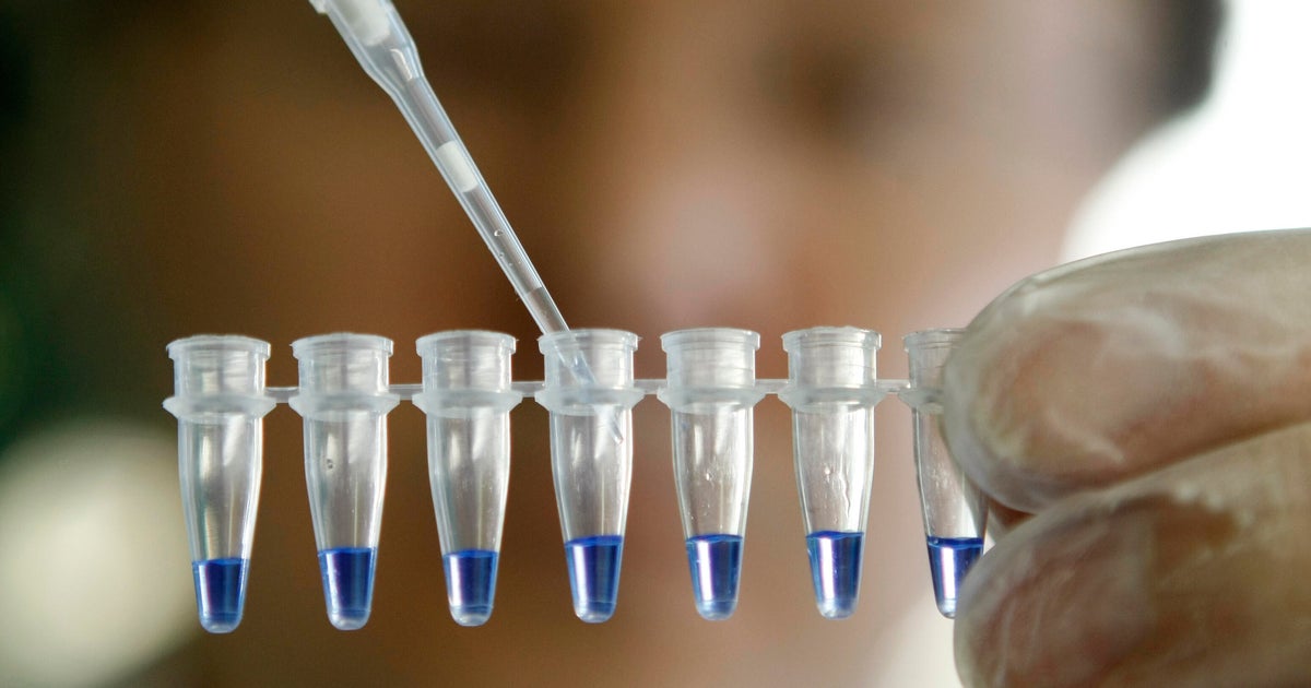 NYC medical examiner to offer free genetic testing to prevent sudden deaths of at-risk people