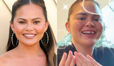 Chrissy Teigen knocks out dental veneer in candy cane game mishap: 'I was trying to create magic'