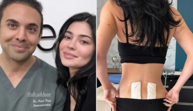 Kylie Jenner Reveals She Underwent Stem Cell Therapy to Get 'Relief' from Chronic Back Pain Following Pregnancy