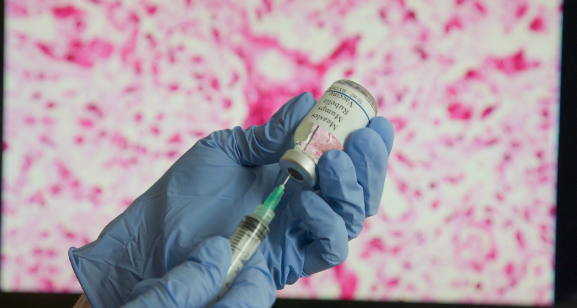 New case raises concerns of silent spread