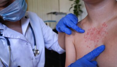 20 more measles cases found in Rockland County, New York, as health leaders urge getting vaccinated
