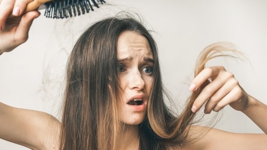 You experience a lot of hairfall with an underactive thyroid. (Shutterstock)