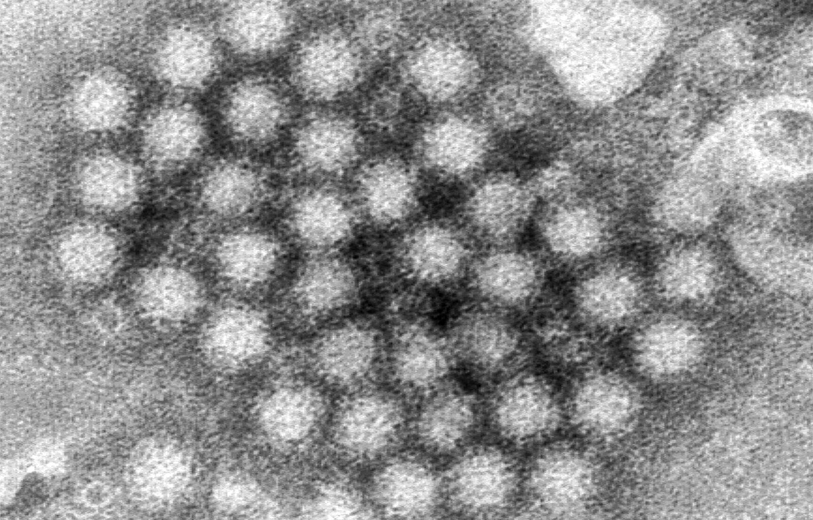 South Jersey elementary school sees stomach bug outbreak