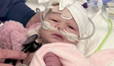 Fort Worth doctor saves the life of baby with rare heart defect